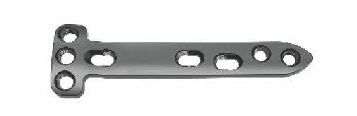 Проксимальна медіальна блокуюча пластина для остеотомії великогомілкової кістки UMP